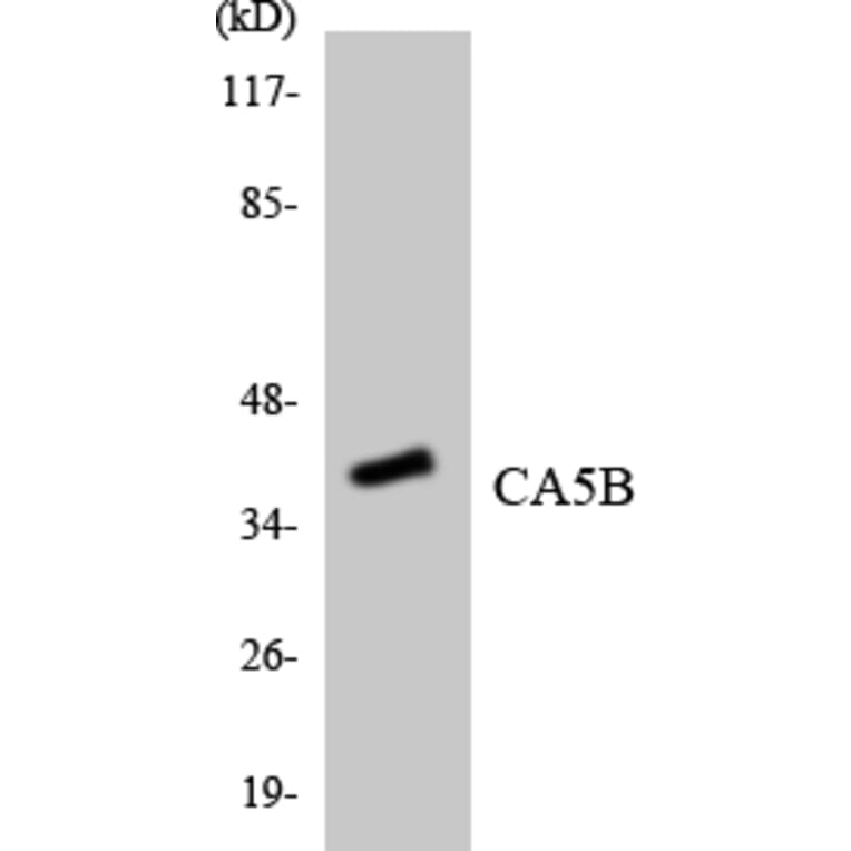 Western Blot - Anti-CA5B Antibody (R12-2558) - Antibodies.com