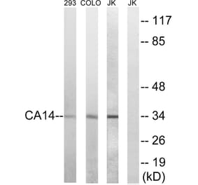 Western Blot - Anti-CA14 Antibody (C14937) - Antibodies.com