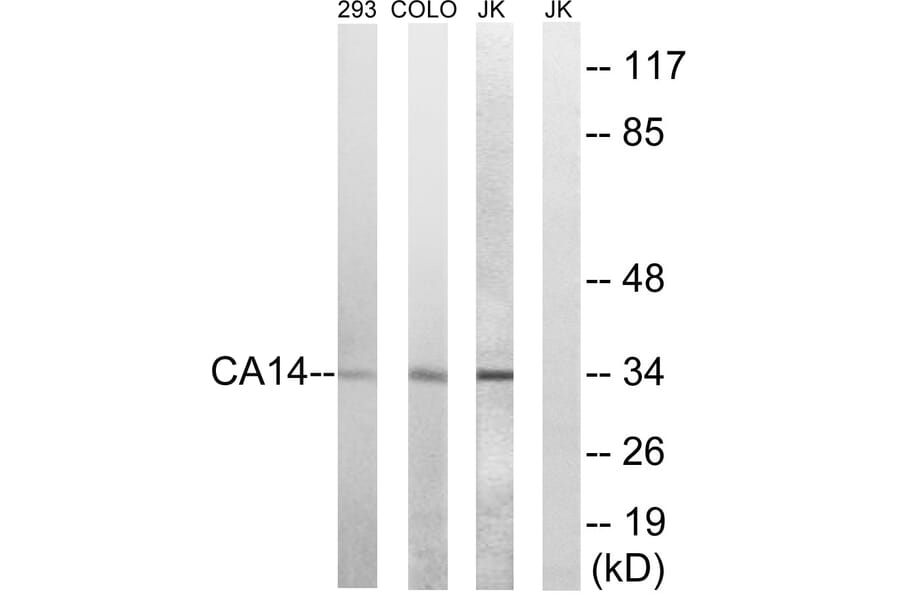 Western Blot - Anti-CA14 Antibody (C14937) - Antibodies.com