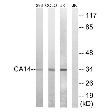 Western Blot - Anti-CA14 Antibody (C14937) - Antibodies.com