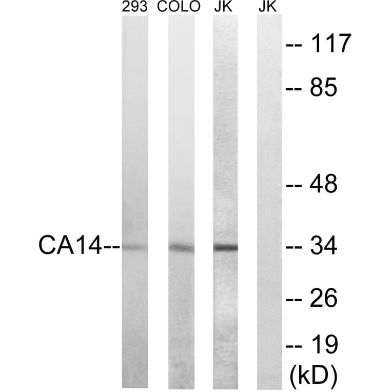 Western Blot - Anti-CA14 Antibody (C14937) - Antibodies.com