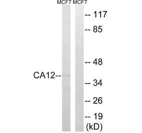 Western Blot - Anti-CA12 Antibody (C14935) - Antibodies.com