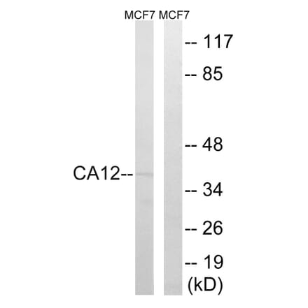 Western Blot - Anti-CA12 Antibody (C14935) - Antibodies.com