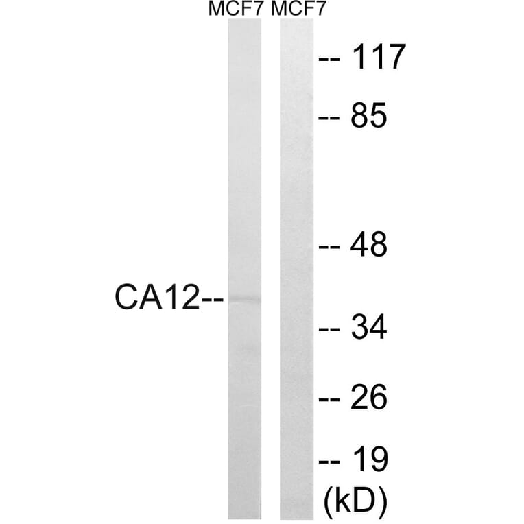 Western Blot - Anti-CA12 Antibody (C14935) - Antibodies.com