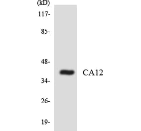 Western Blot - Anti-CA12 Antibody (R12-2554) - Antibodies.com