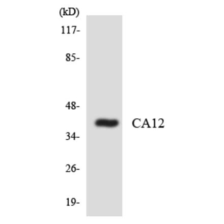 Western Blot - Anti-CA12 Antibody (R12-2554) - Antibodies.com