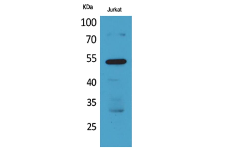 Western Blot - Anti-BMP3 Antibody (C30667) - Antibodies.com