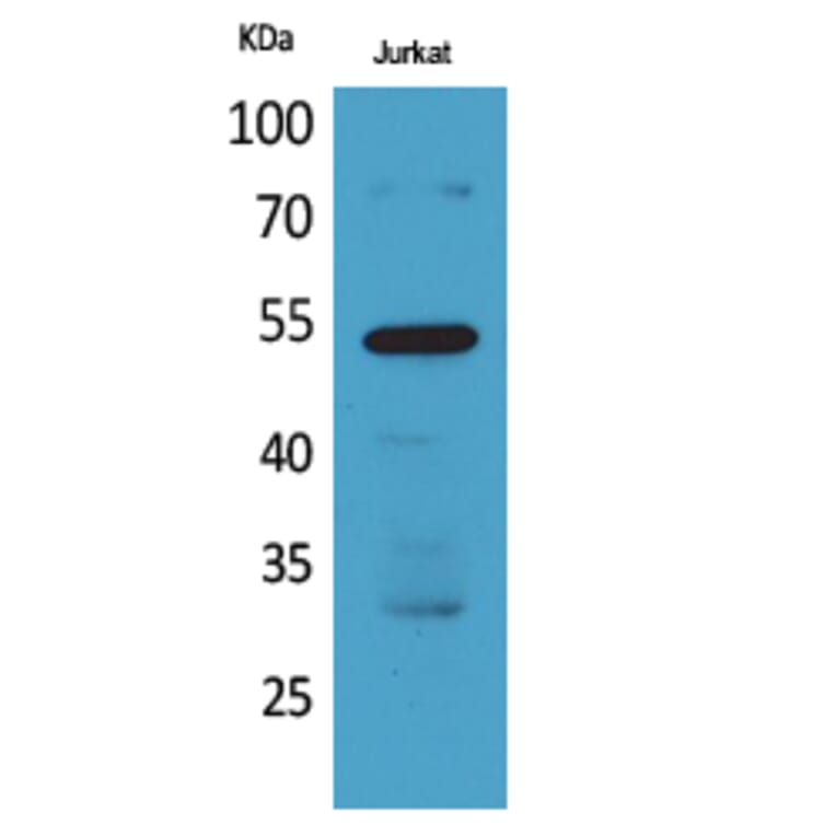 Western Blot - Anti-BMP3 Antibody (C30667) - Antibodies.com