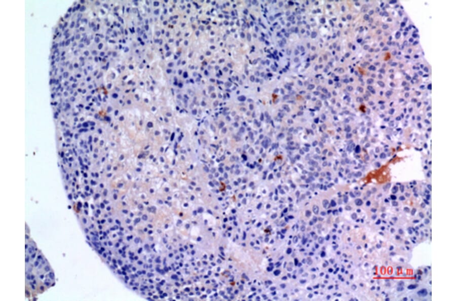Immunohistochemistry - Anti-BMP3 Antibody (C30667) - Antibodies.com