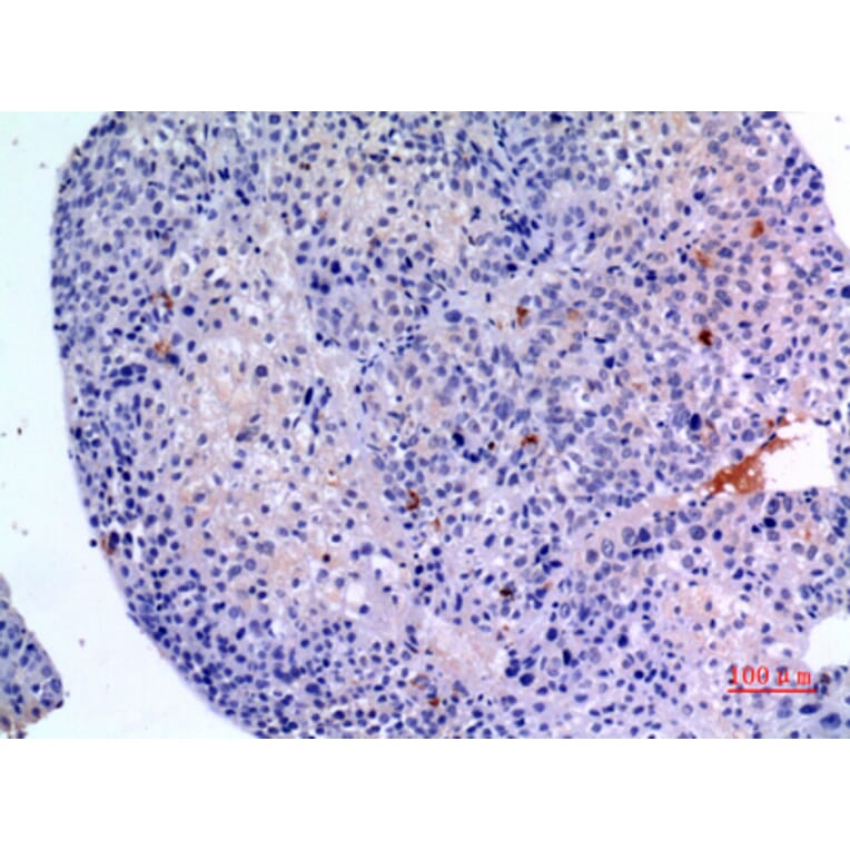 Immunohistochemistry - Anti-BMP3 Antibody (C30667) - Antibodies.com