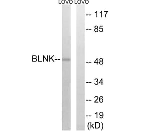 Western Blot - Anti-BLNK Antibody (B0620) - Antibodies.com