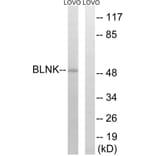 Western Blot - Anti-BLNK Antibody (B0620) - Antibodies.com