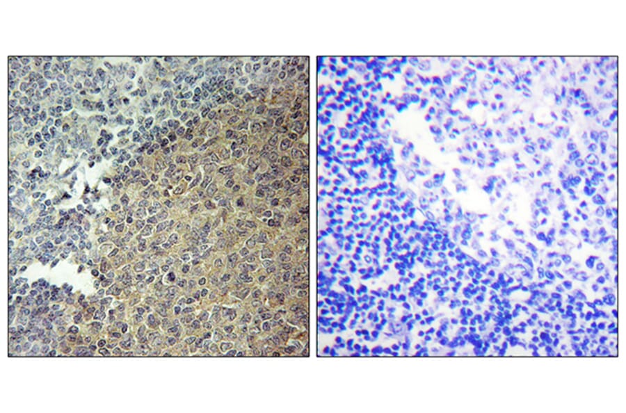 Immunohistochemistry - Anti-BLNK Antibody (B0620) - Antibodies.com