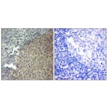 Immunohistochemistry - Anti-BLNK Antibody (B0620) - Antibodies.com