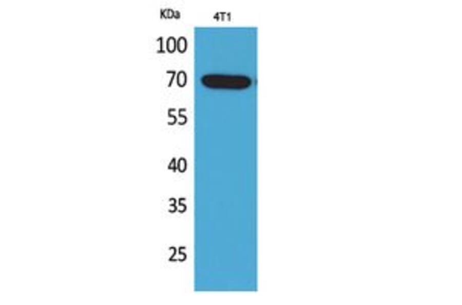 Western Blot - Anti-BIN1 Antibody (C30020) - Antibodies.com