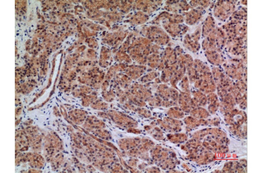 Immunohistochemistry - Anti-BIN1 Antibody (C30020) - Antibodies.com