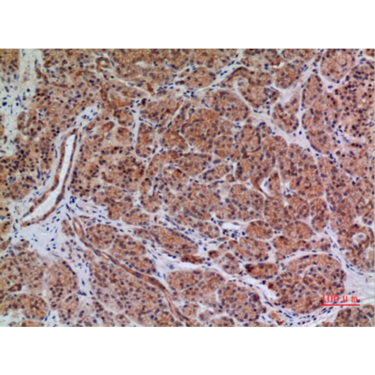 Immunohistochemistry - Anti-BIN1 Antibody (C30020) - Antibodies.com
