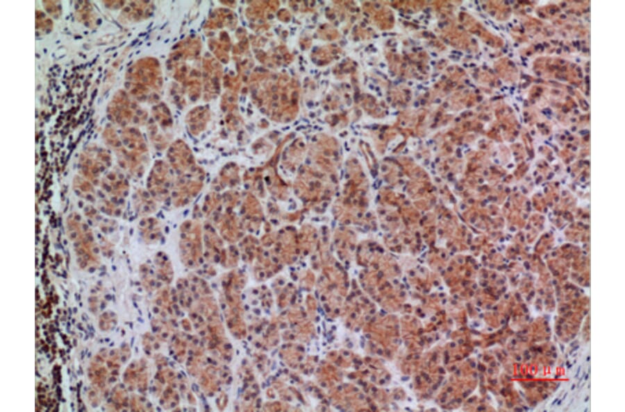 Immunohistochemistry - Anti-BIN1 Antibody (C30020) - Antibodies.com
