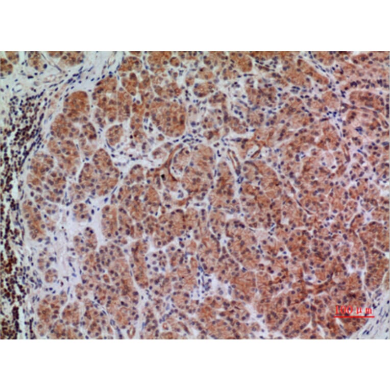 Immunohistochemistry - Anti-BIN1 Antibody (C30020) - Antibodies.com