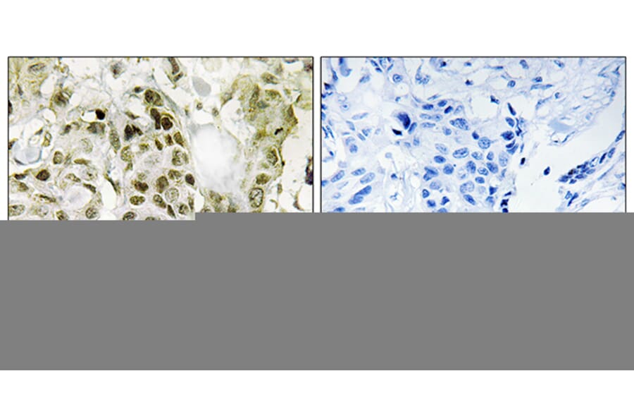 Immunohistochemistry - Anti-BCOR Antibody (C12072) - Antibodies.com