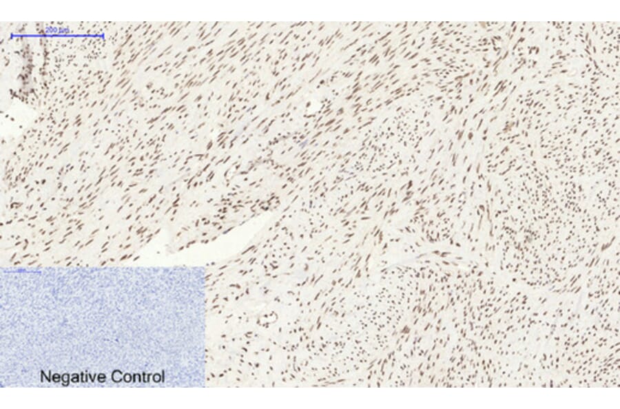 Immunohistochemistry - Anti-BCL6 Antibody (C30745) - Antibodies.com