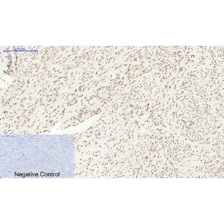 Immunohistochemistry - Anti-BCL6 Antibody (C30745) - Antibodies.com