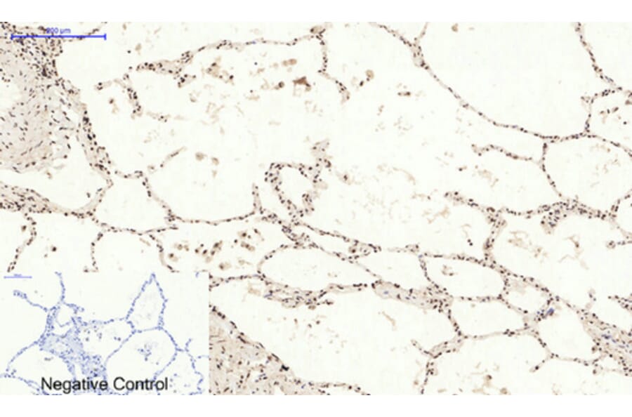 Immunohistochemistry - Anti-BCL6 Antibody (C30745) - Antibodies.com