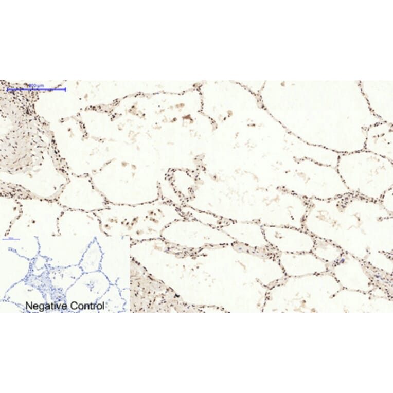 Immunohistochemistry - Anti-BCL6 Antibody (C30745) - Antibodies.com