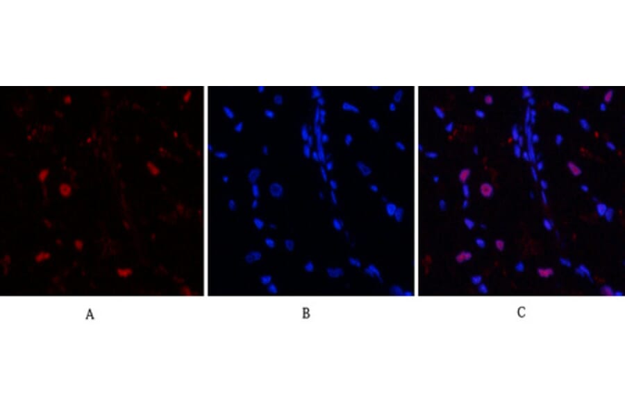 Immunofluorescence - Anti-BCL6 Antibody (C30745) - Antibodies.com