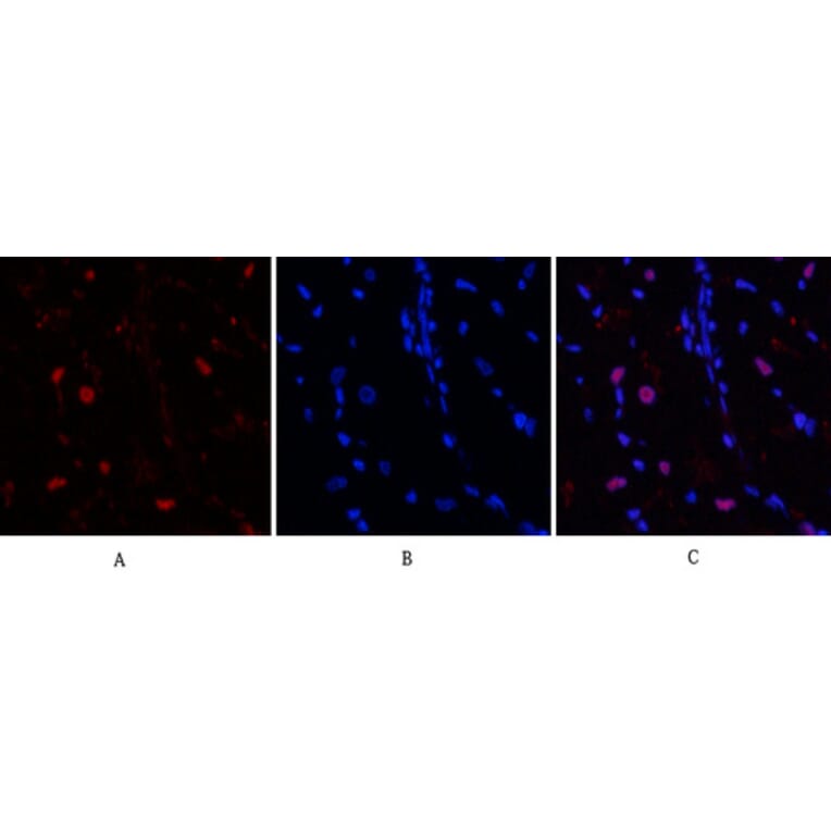 Immunofluorescence - Anti-BCL6 Antibody (C30745) - Antibodies.com
