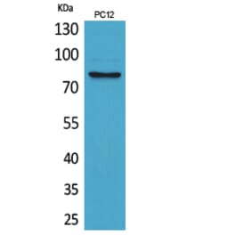 Western Blot - Anti-BCAM Antibody (C30518) - Antibodies.com