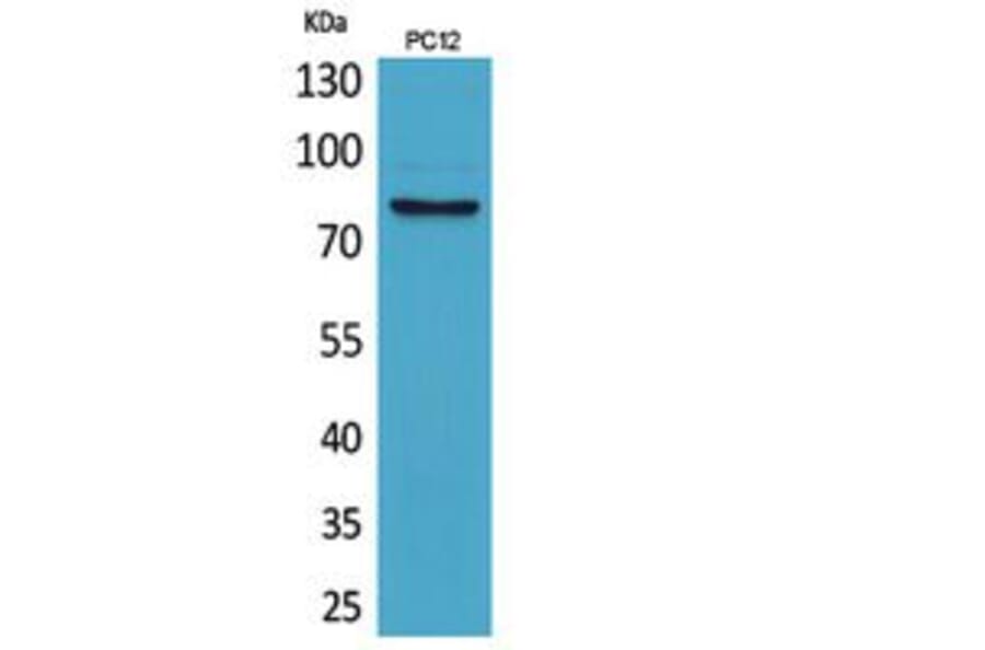Western Blot - Anti-BCAM Antibody (C30518) - Antibodies.com