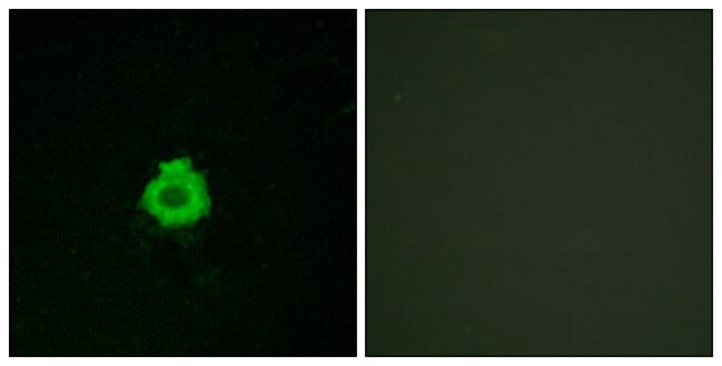 Immunofluorescence analysis of HUVEC cells using Anti-BAI2 Antibody. The right hand panel represents a negative control, where the antibody was pre-incubated with the immunising peptide.