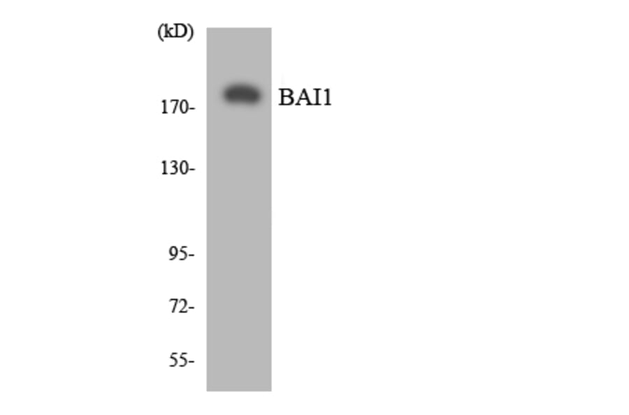 Western Blot - Anti-BAI1 Antibody (R12-2534) - Antibodies.com