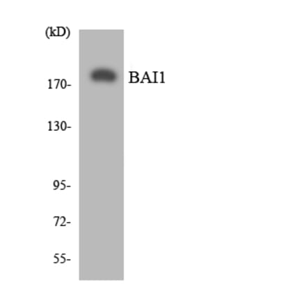 Western Blot - Anti-BAI1 Antibody (R12-2534) - Antibodies.com