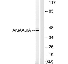 Western Blot - Anti-AurA Antibody (B1132) - Antibodies.com