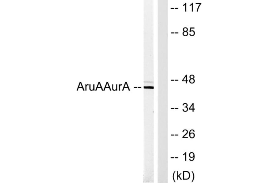 Western Blot - Anti-AurA Antibody (B1132) - Antibodies.com