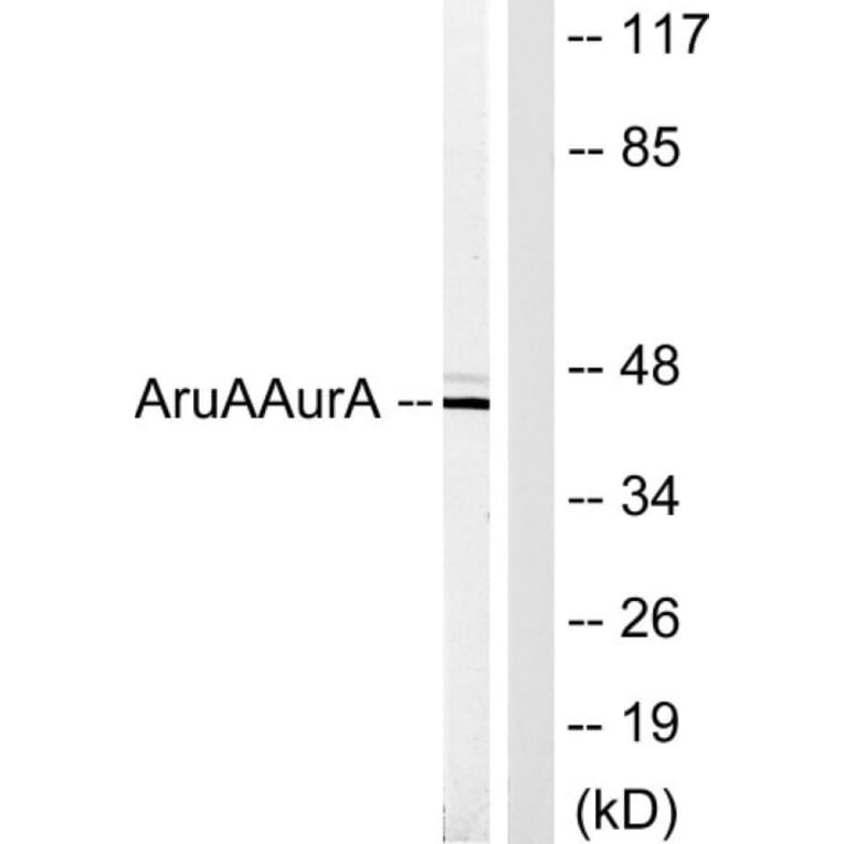 Western Blot - Anti-AurA Antibody (B1132) - Antibodies.com