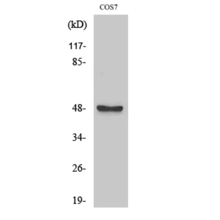 Western Blot - Anti-AurA Antibody (B1132) - Antibodies.com