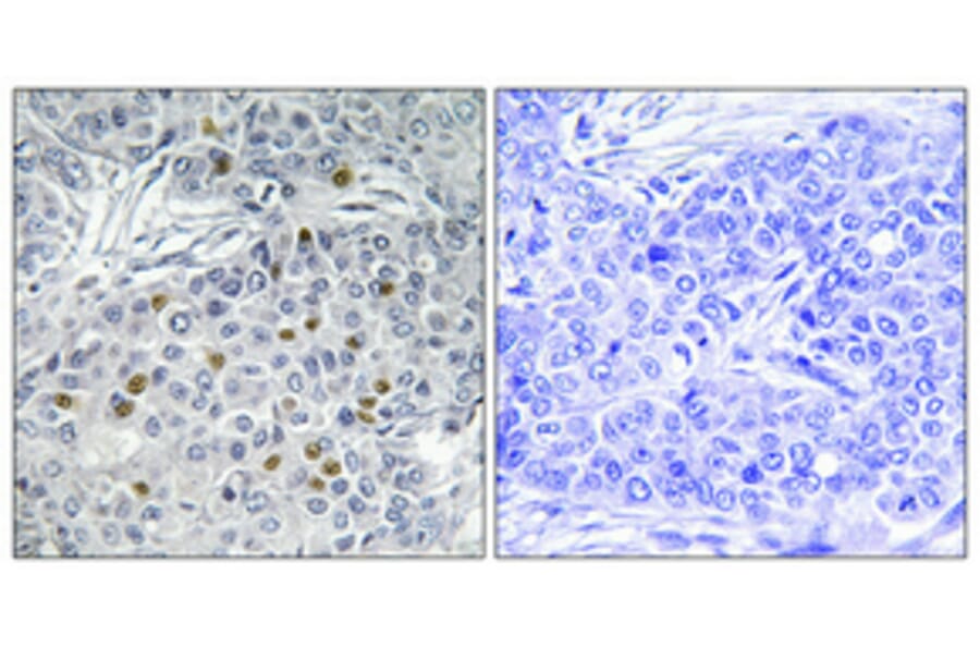 Immunohistochemistry - Anti-AurA Antibody (B1132) - Antibodies.com