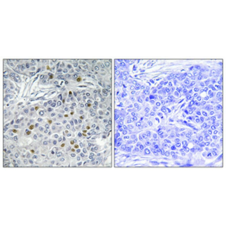 Immunohistochemistry - Anti-AurA Antibody (B1132) - Antibodies.com