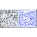 Immunohistochemistry - Anti-AurA Antibody (B1132) - Antibodies.com