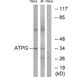 Western Blot - Anti-ATPG Antibody (C14596) - Antibodies.com