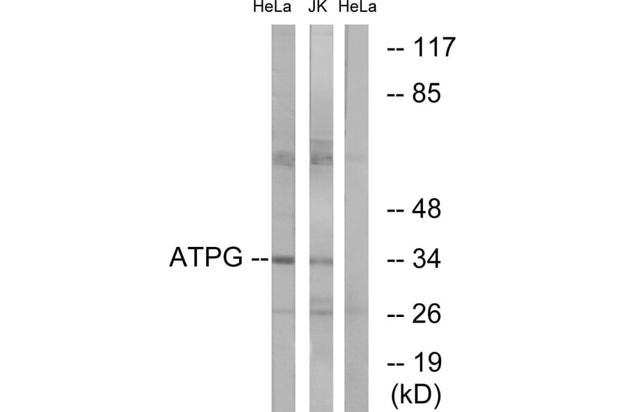 Western Blot - Anti-ATPG Antibody (C14596) - Antibodies.com