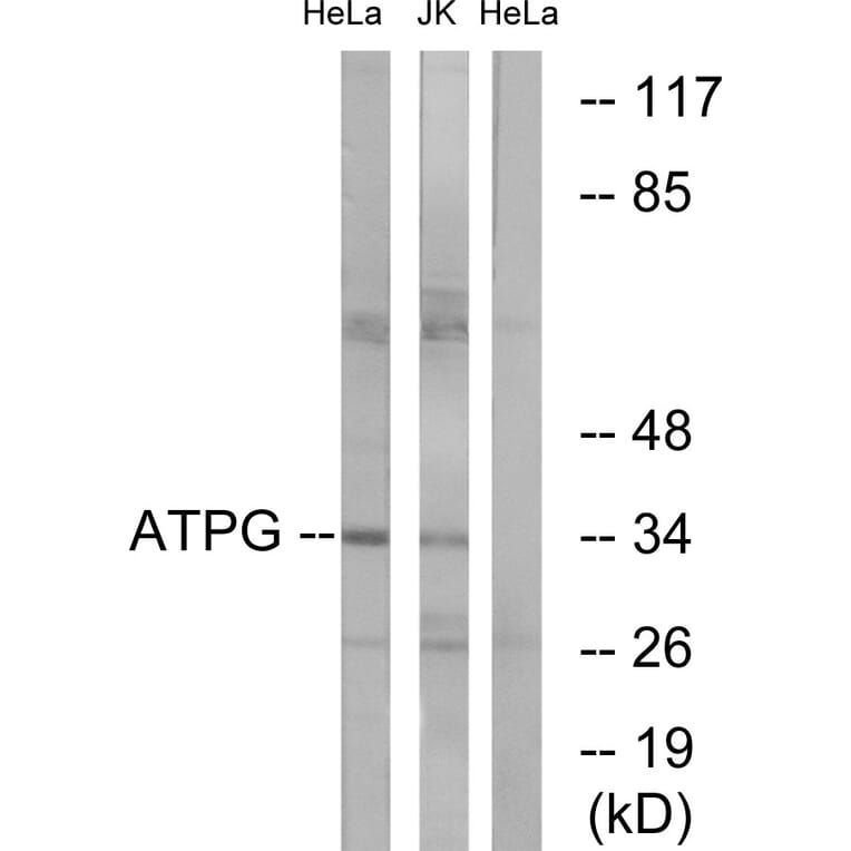 Western Blot - Anti-ATPG Antibody (C14596) - Antibodies.com