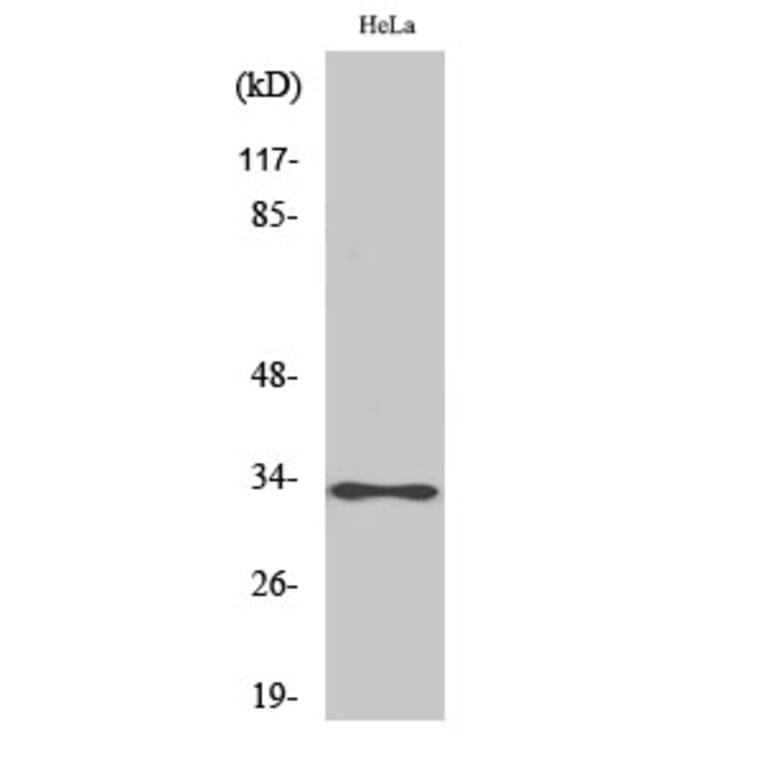 Western Blot - Anti-ATPG Antibody (C14596) - Antibodies.com