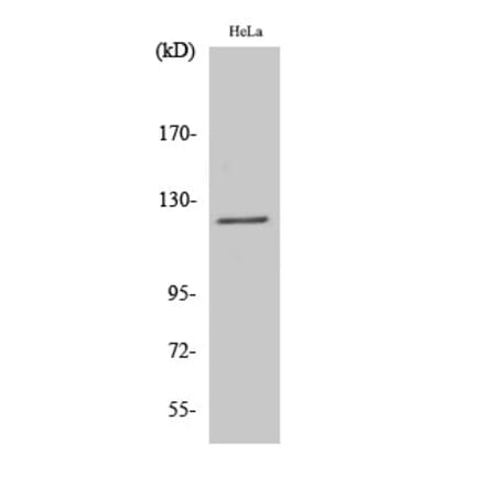 Western Blot - Anti-ATN1 Antibody (C14668) - Antibodies.com