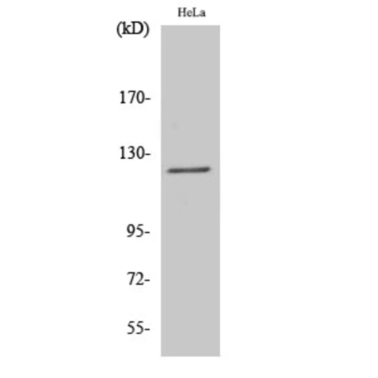 Western Blot - Anti-ATN1 Antibody (C14668) - Antibodies.com