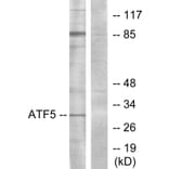 Western Blot - Anti-ATF5 Antibody (C11931) - Antibodies.com