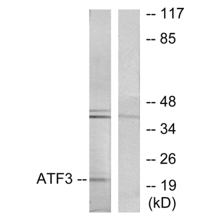 Western Blot - Anti-ATF3 Antibody (C10420) - Antibodies.com